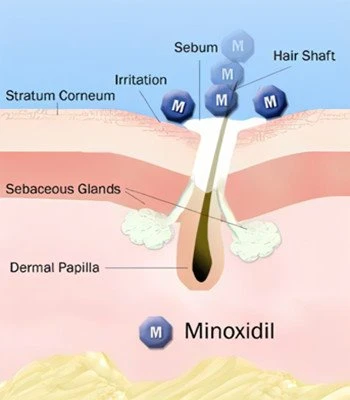 minoxidil 1