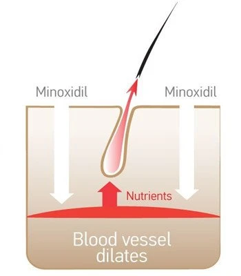 minoxidil 2